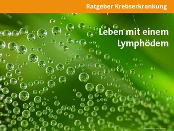 Ratgeber Leben mit Lymphödem